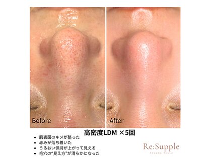 リサプリ(Re: Supple)の写真