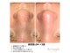 リサプリ(Re: Supple)の写真