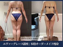 エヴァーグレース 宇都宮店/ 燃焼系BODY作りサポートします