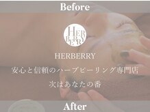 ハーバリー ハーブピーリング 難波心斎橋店(HERBERRYハーブピーリング)/ボディハーブピーリングも大人気