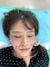美容鍼×フェイシャル×頭皮鍼自律神経調整コース¥8000
