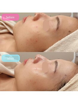 ベルチェリカ(Belle CHERIKA)/クリスティーナ・イラストリアス