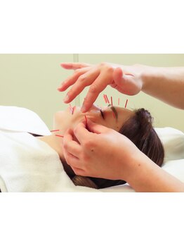 鍼灸施術を受けたい