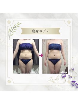 アディッシモ(addissimo)/痩身メニューを豊富にご用意♪