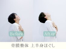 ヒラメント 桜新町(Hilament)/首こりビフォーアフター〈整体〉