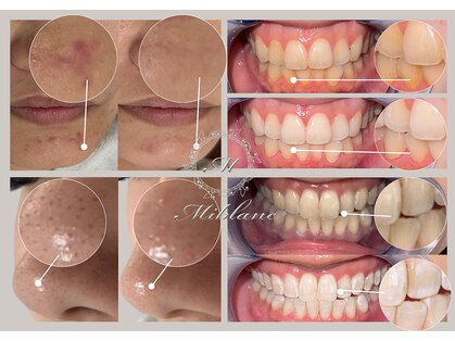 ミブラン 上野店(MIBLANC)の写真