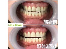 ルブラン 奈良店(Le Blanc)/白くするだけじゃない！！