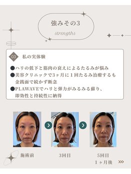 ソルイルナ 麻布十番店(sol y luna)/たるみだって【継続は力なり】