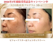 デアマリス