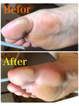 アンベリール ネイルサロンアンドスクール(embellir)/