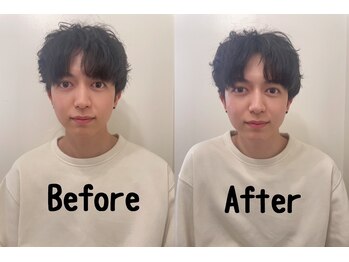 コガオファクトリー 北24条店(KOGAO FACTORY)/【自分史上最小の小顔へ！】