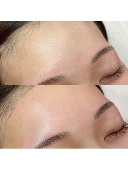 ホワイトアイ 堺東(WHITE EYE)/◇ツルツル卵肌に!!