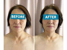 盤美(バンビ)の雰囲気(フェイシャルでは美しくなる事はもとより首肩の疲れも改善します)