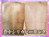 【見られていますよ背中】<背中美人>剥離なしシリカニードルで頑固な背中ケア