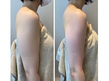 エイシスグロウ(asis glow.)/効果写真