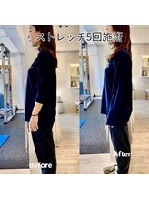 リバイブ 五反田店(REVIVE)/姿勢改善/ストレッチ5回施術