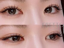 エレット 茗荷谷店(ERETTO)