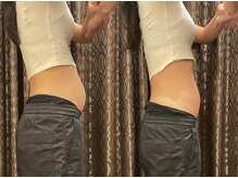 アクトベレッザ(Act BELLEZZA)/スキンジェクション：PENTIDE