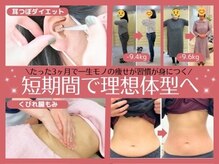 スナオダイエット けやき台(SunaoDiet)