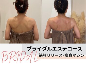 痩身&ブライダルエステサロン MillS 小倉店【3/2 NEW OPEN（予定）】/ブライダルエステコース