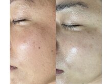 エッセンシャル 南海難波店(ESSENTIAL)/ララピール