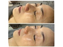 サロン デ ヴィオテラス(salon des vioterrasse)の雰囲気(認定講師が施術する韓国美肌管理No.1【ララピール】)