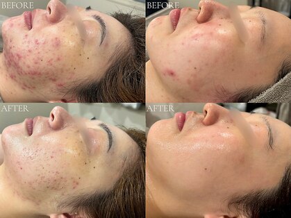 ベベ 表参道(bebe)の写真