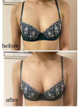 コティーバイホイヤ(Cotty by HOIYA)/◎ふわふわバストマッサージ