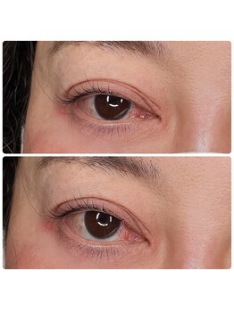 ヴァーチュープラス(VIRTUE PLUS)/