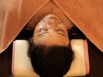 プラステン治療院 / コットンタイム/金鍼を使った最上級な美容鍼