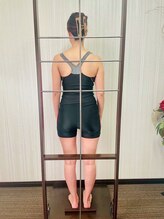 キナーレ 大宮(Kina-re)/検査施術前/肩甲骨/姿勢/小顔
