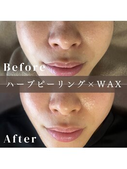 エピナ 秋田店(Epina)/フェイシャルWAX+ハーブ★