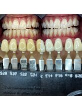 トウキョウスワーズ 池袋店(TOKYO SWRS)/#ホワイトニング #池袋 #渋谷