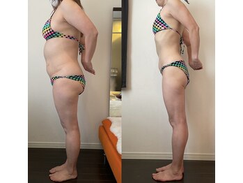 レナトゥス 銀座(Renatus)/BeforeAfter【痩身/東京/銀座】