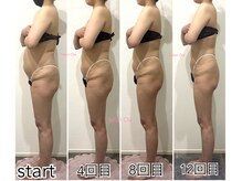 サロン イア(Salon Oia)の雰囲気（コリもむくみもダイエットも気になる方にオススメ！筋膜リリース）