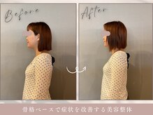 ほぐし屋 かすがい/猫背巻き肩矯正