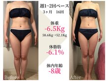 ベルタ 仙台店(BELTA)/【ケア前→後】3ヶ月で-6.5キロ