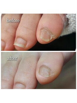 爪切り屋 足楽/