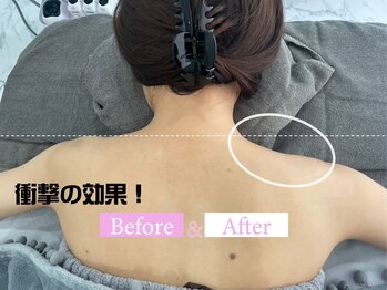 カンナムビューティー 新宿 代々木/オンダリフト/新宿/ララピール