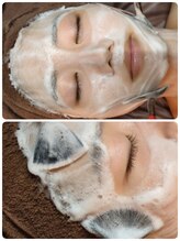 ウララ(ulala)/ララピールの洗顔