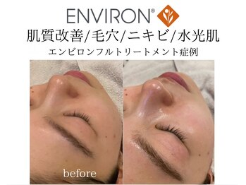 ヴィディトゥ(vidyto)