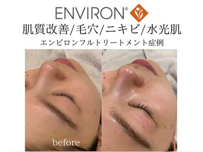 ヴィディトゥ(vidyto)の写真