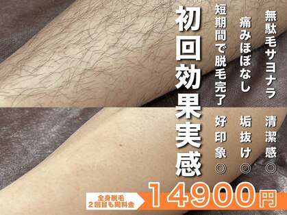 メンズ脱毛サロン ボス(BOSS)の写真