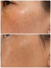 ペリドット(Peridot)/ルナシューネ化粧品