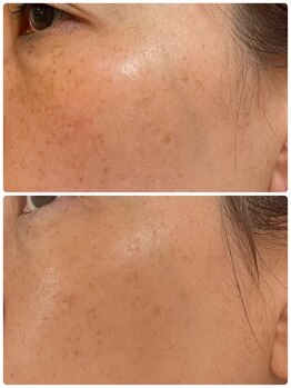 ペリドット(Peridot)/ルナシューネ化粧品