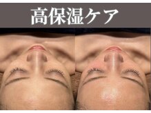 マヴィ 守口店(MavY.)/ツヤっとお肌に！