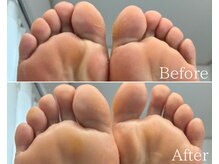 カシェット 広島店(Cachette)/50代女性☆足裏角質ケア90分