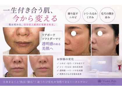 ヴィオレ パール(violet pale)の写真