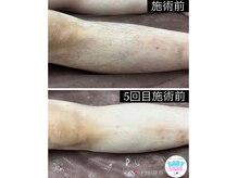 ベイビースキン(Baby skin)の雰囲気（【脱毛】メンズ脱毛も大歓迎◎）