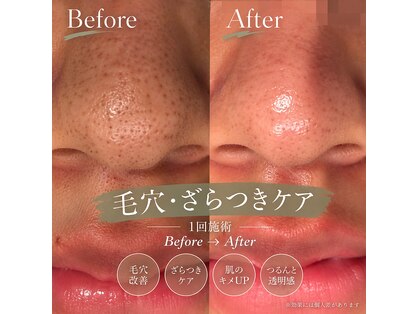 トリン 神戸 長田(Trin)の写真